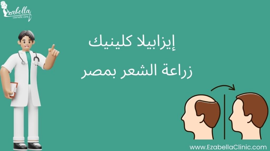 زراعة الشعر بمصر